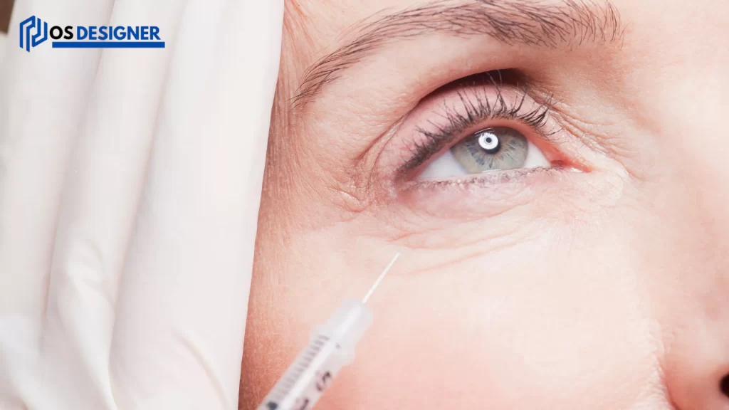 Close-up of Botox injection near eye - How long does Botox last?